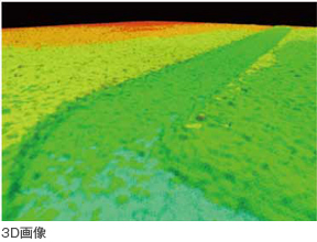 3D画像